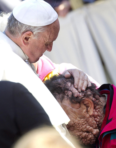El abrazo del Papa Francisco con un enfermo, en noviembre de 2013.
