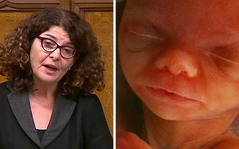 La parlamentaria Diana Johnson es la autora de la enmienda. A la derecha, feto de 28 semanas