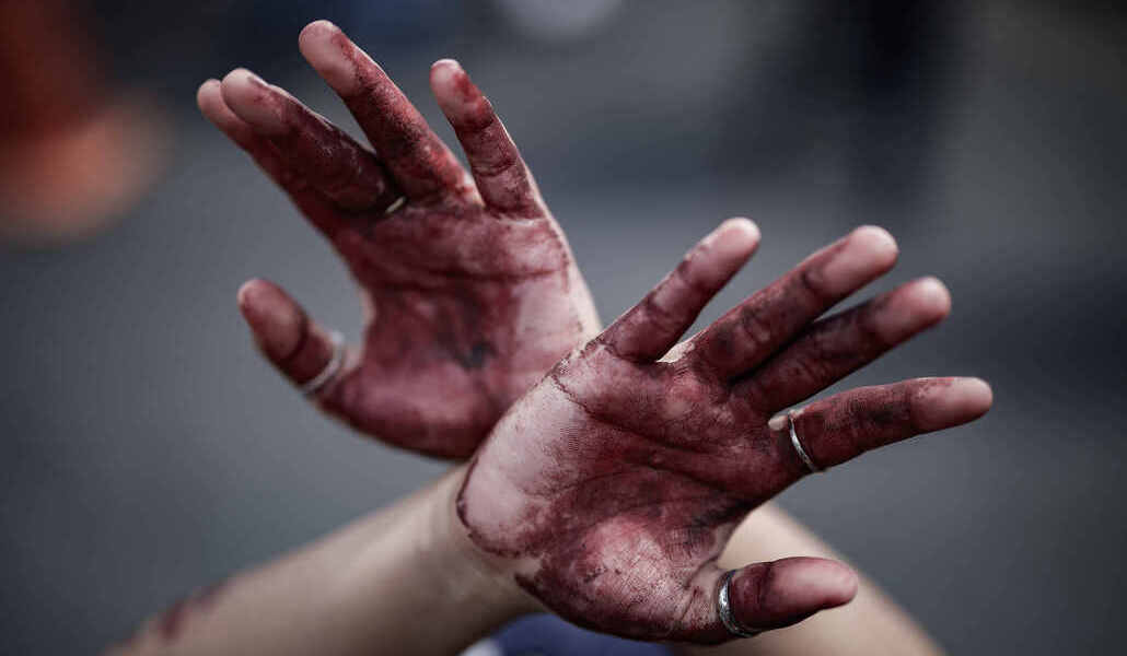 Manos ensangrentadas en una manifestación contra el Gobierno costarricense por la eliminación de programas de sexualidad integral, el 5 de febrero